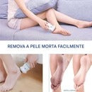 Removedor de Calos Elétrico Fourlove com Aspirador