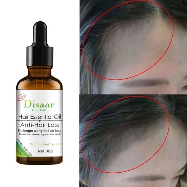 Disaar Anti-Hair Loss — Menos Queda, Mais Força