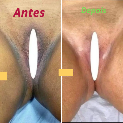 Sérum Clareador de partes Escuras